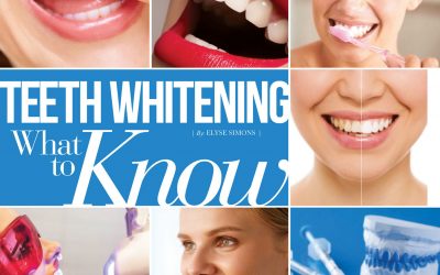 Teeth Whitening What to Know